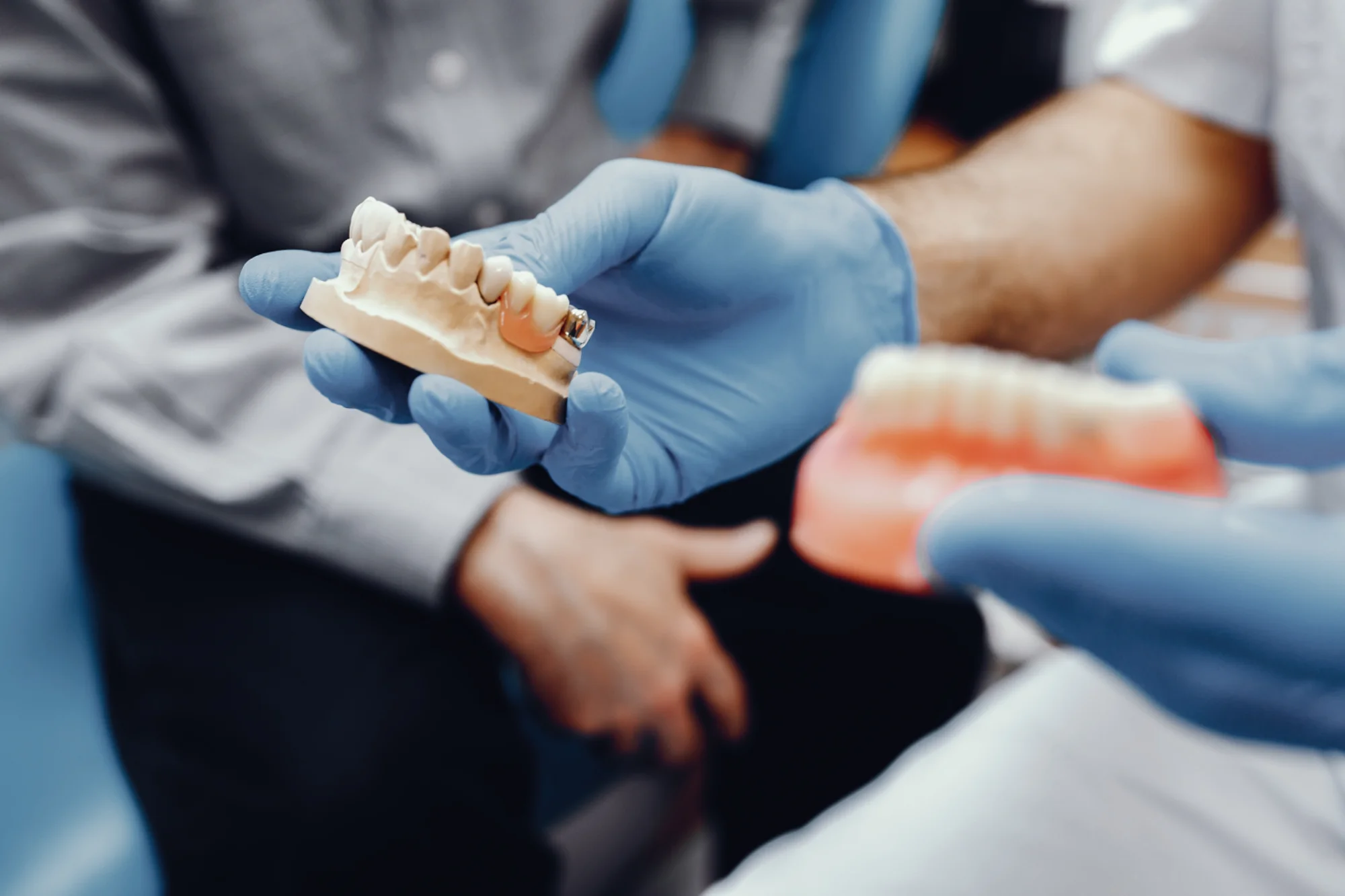 Implantes dentales en Barcelona